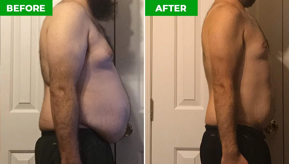 SlimBliss Before and After